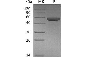 IL-15/IL-15R protein (Fc Tag)