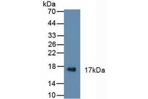 Figure. (CST6 antibody  (AA 29-149))