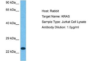 Host: Rabbit Target Name: KRAS Sample Tissue: Human Jurkat Whole Cell Antibody Dilution: 1ug/ml (K-RAS antibody  (N-Term))