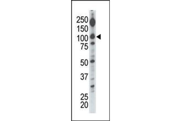 DGKI antibody  (C-Term)