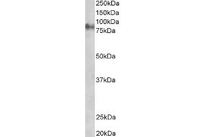 ABIN184775 staining (1µg/ml) of Rat Eye lysate (RIPA buffer, 35µg total protein per lane). (JUP antibody  (C-Term))