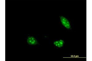 Immunofluorescence of monoclonal antibody to PIM1 on HeLa cell. (PIM1 antibody  (AA 1-100))