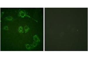 Immunofluorescence analysis of HuvEc cells, using COT (Ab-290) Antibody. (CROT antibody  (AA 256-305))