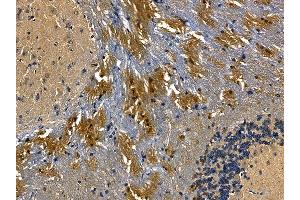 MLC1 Antibody at 1/100 staining mouse brain tissue by IHC-P. (MLC1 antibody)