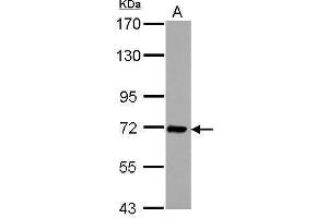 WB Image Sample (30 ug of whole cell lysate) A: Jurkat 7. (IL1RAP antibody)