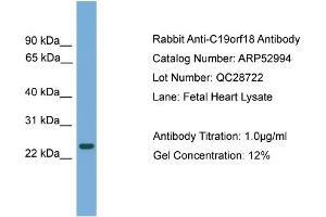 WB Suggested Anti-C19orf18  Antibody Titration: 0. (C19orf18 antibody  (N-Term))