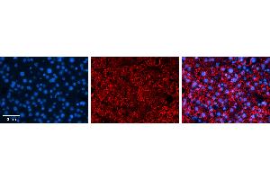 Rabbit Anti-ZNF259 Antibody   Formalin Fixed Paraffin Embedded Tissue: Human Liver Tissue Observed Staining: Nucleus and cytoplasm in hepatocytes Primary Antibody Concentration: N/A Other Working Concentrations: 1:600 Secondary Antibody: Donkey anti-Rabbit-Cy3 Secondary Antibody Concentration: 1:200 Magnification: 20X Exposure Time: 0. (ZNF259 antibody  (C-Term))