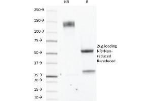 SDS-PAGE (SDS) image for anti-Estrogen Receptor 2 (ESR2) (C-Term) antibody (ABIN6939350)
