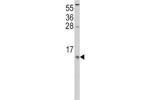 Western Blotting (WB) image for anti-Chemokine (C-C Motif) Ligand 2 (CCL2) antibody (ABIN3002757) (CCL2 antibody)