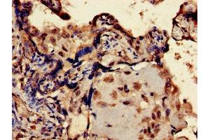 Immunohistochemistry of paraffin-embedded human placenta tissue using ABIN7151618 at dilution of 1:100 (ERVK-6 antibody  (AA 90-632))