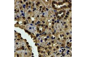 Immunohistochemical analysis of Karyopherin alpha-6 staining in human kidney formalin fixed paraffin embedded tissue section.