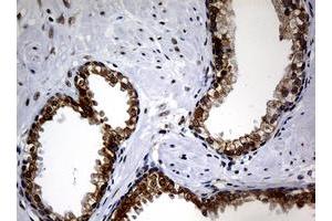 Image no. 2 for anti-Nibrin (NBN) (AA 461-754) antibody (ABIN1491539) (Nibrin antibody  (AA 461-754))