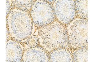 ABIN7094548 and ABIN7098597 at 1/100 staining Rat testis tissue by IHC-P.