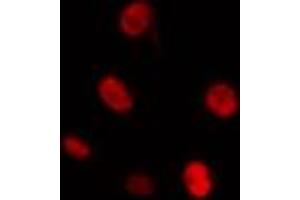 ABIN6274298 staining Hela cells by IF/ICC. (CKS1 antibody  (N-Term))