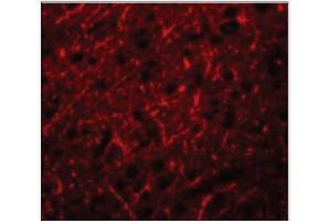 Immunofluorescence of PRDM16 in Human Brain cells with PRDM16 Antibody  at 20 µg/ml.
