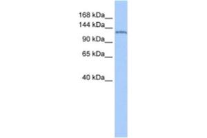 Western Blotting (WB) image for anti-Nucleoporin 155kDa (NUP155) antibody (ABIN2463616) (NUP155 antibody)
