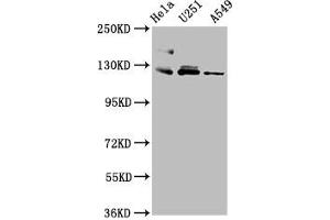 Western Blot Positive WB detected in: Hela whole cell lysate, U251 whole cell lysate, A549 whole cell lysate All lanes: FBLN2 antibody at 3. (FBLN2 antibody  (AA 301-440))