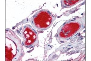 Small intestine, vessels: Formalin-Fixed, Paraffin-Embedded (FFPE) (Coagulation Factor X antibody)
