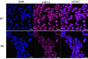 anti-Structural Maintenance of Chromosomes 1A (SMC1A) antibody