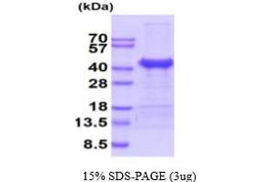 SDS-PAGE (SDS) image for Cathepsin L1 (CTSL1) (AA 18-333) protein (His tag) (ABIN5854828) (Cathepsin L Protein (AA 18-333) (His tag))
