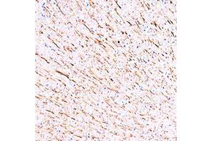 Immunohistochemistry (Formalin/PFA-fixed paraffin-embedded sections) staining of rat brain using Map1a monoclonal antibody, clone MP-1 . (MAP1A antibody)