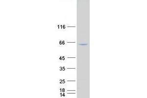 Western Blotting (WB) image for Nuclear Factor-kB p65 (NFkBP65) (Transcript Variant 1) (Active) protein (Myc-DYKDDDDK Tag) (ABIN2730698)