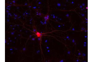Indirect immunostaining of PFA fixed rat hippocampus neurons (dilution 1 : 500; red). (Calbindin D28k/D29k antibody)