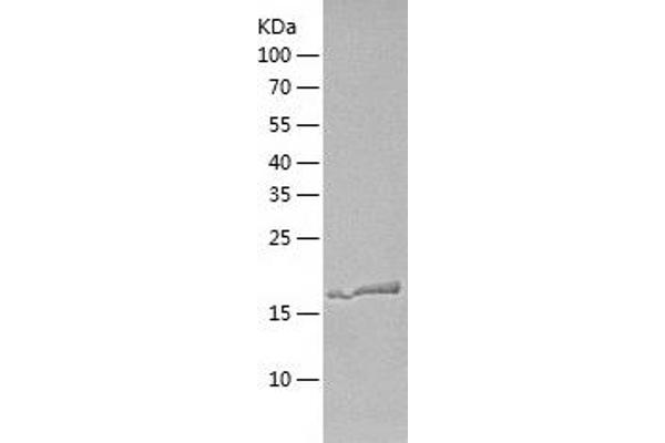 Retinoic Acid Early Transcript 1G (RAET1G) (AA 26-213) protein (His tag)