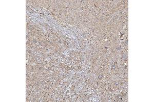 IHC analysis of SLC20A1 using anti-SLC20A1 antibody (ABIN7602463).