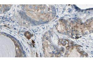 ABIN6275372 at 1/100 staining Human prostate tissue by IHC-P. (KCNK15 antibody  (C-Term))