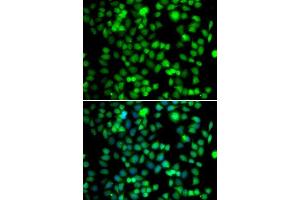 Immunofluorescence analysis of A-549 cells using FKBP6 antibody. (FKBP6 antibody  (AA 1-327))