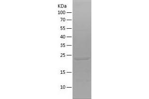 FGD5 Protein (AA 435-639) (His tag)