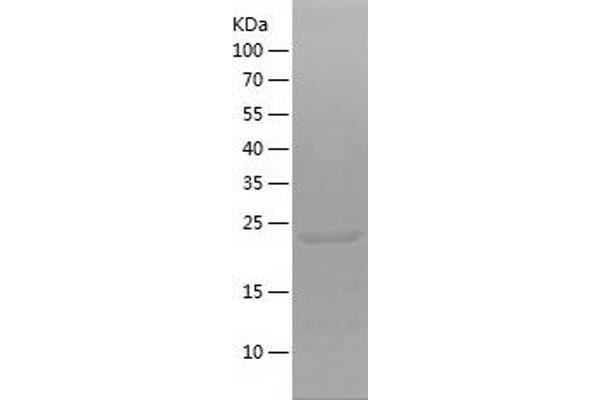 FGD5 Protein (AA 435-639) (His tag)