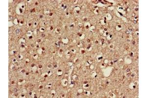 Immunohistochemistry of paraffin-embedded human brain tissue using ABIN7146747 at dilution of 1:100