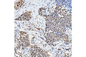 IHC analysis of SNRNP27 using anti-SNRNP27 antibody (ABIN7599614). (SNRNP27 antibody  (AA 100-155))