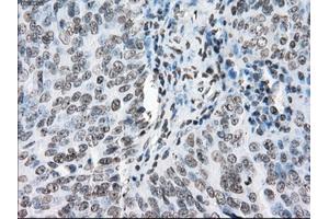 Immunohistochemical staining of paraffin-embedded endometrium tissue using anti-PORmouse monoclonal antibody. (POR antibody)