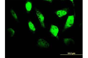 Immunofluorescence of monoclonal antibody to TCF4 on HeLa cell. (TCF4 antibody  (AA 1-365))