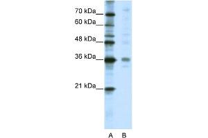 WB Suggested Anti-CRSP8 Antibody Titration:  5. (MED27 antibody  (C-Term))