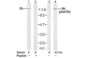 Image no. 2 for anti-Retinoblastoma 1 (RB1) (Ser780) antibody (ABIN197284) (Retinoblastoma 1 antibody  (Ser780))