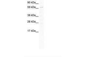 Image no. 1 for anti-Signal Transducer and Activator of Transcription 1, 91kDa (STAT1) (AA 258-307) antibody (ABIN202899)