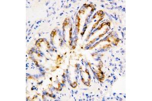 Anti-Calpain 1 antibody, IHC(P) IHC(P): Rat Lung Tissue