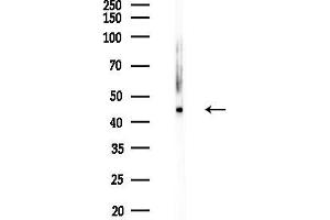anti-Transmembrane Protein 237 (TMEM237) (Internal Region) antibody