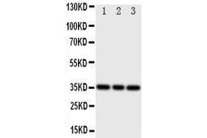 Anti-Bone Sialoprotein antibody, Western blotting Lane 1: Rat Liver Tissue Lysate Lane 2: Rat Brain Tissue Lysate Lane 3: Rat Kidney Tissue Lysate (IBSP antibody  (C-Term))
