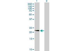 Western Blot analysis of PDGFA expression in transfected 293T cell line by PDGFA MaxPab polyclonal antibody. (PDGFA antibody  (AA 1-211))