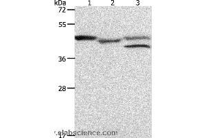 Western blot analysis of K562 cell and mouse heart tissue, MCF7 cell, using PSMD6 Polyclonal Antibody at dilution of 1:900 (PSMD6 antibody)
