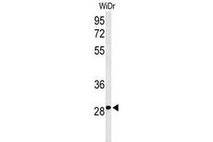 Western blot analysis of C9orf95 Antibody (N-term) in WiDr cell line lysates (35µg/lane).