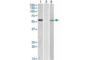 HEK293 lysate (10 ug protein in RIPA buffer) overexpressing human MGAT1 with C-terminal MYC tag probed with MGAT1 polyclonal antibody (Cat # PAB18956, 1 ug/mL) in Lane A and probed with anti-MYC Tag (1/1000) in lane C.