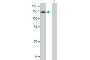 Western Blot analysis of DNMT3A expression in transfected 293T cell line by DNMT3A MaxPab polyclonal antibody. (DNMT3A antibody  (AA 1-912))