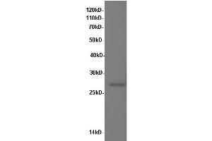 Western Blotting (WB) image for anti-Interleukin 10 (IL10) antibody (ABIN5957052) (IL-10 antibody)