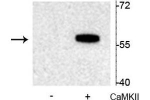 Western blot of recombinant tryptophan hydroxylase incubated in the absence (-) and presence (+) of  Ca2+/calmodulin dependent kinase II showing specific immunolabeling of the ~55 kDa tryptophan hydroxylase protein phosphorylated at Ser19. (Tryptophan Hydroxylase 2 antibody  (pSer19))